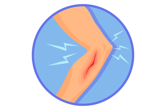 Human Leg with Bleeding Wound. Medical I Graphics